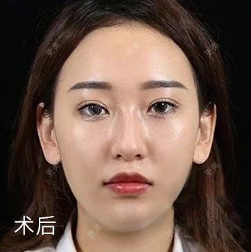 涂艳丽 医生