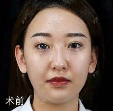 涂艳丽 医生