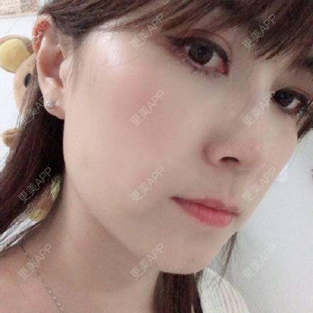 更美 - 更美用户F9mNhf6bwI的脱唇毛经验 | 脱唇毛 | 上海