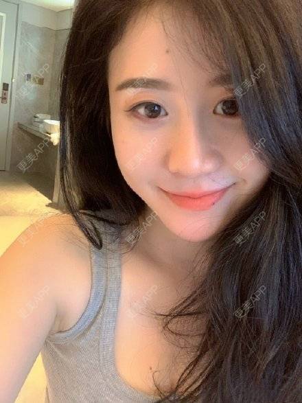 更美 - 更美用户F9mNhf6bwI的改善动态纹经验 | 改善动态纹 | 上海