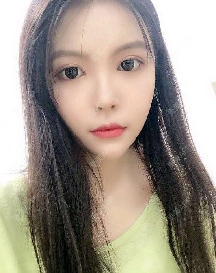 更美 - 更美用户F9mNhf6bwI的改善面部细纹经验 | 改善面部细纹 | 上海