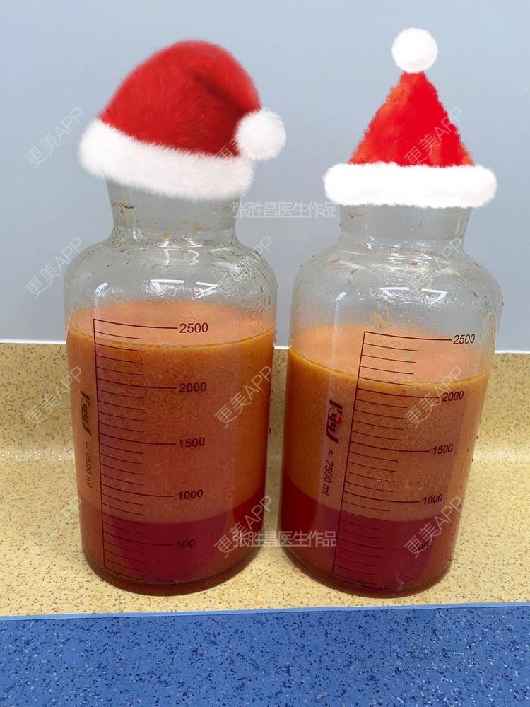 更美 - 更美用户TTx0mKb4QJ的吸脂瘦大腿经验 | 吸脂瘦大腿 | 广州