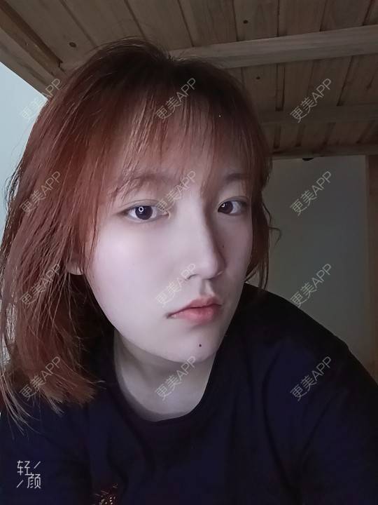 更美 - 更美用户tbs28rKiLZ的玻尿酸卧蚕经验 | 玻尿酸卧蚕 | 杭州