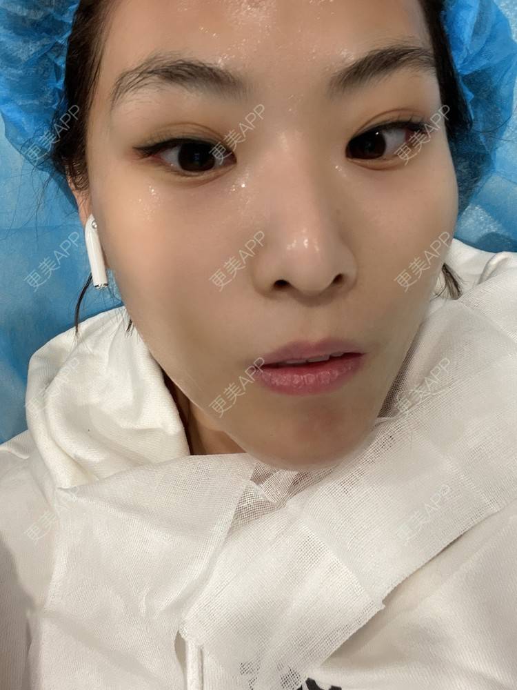 更美 - 麦可星-喵的水光项目经验 | 水光项目 | 大连