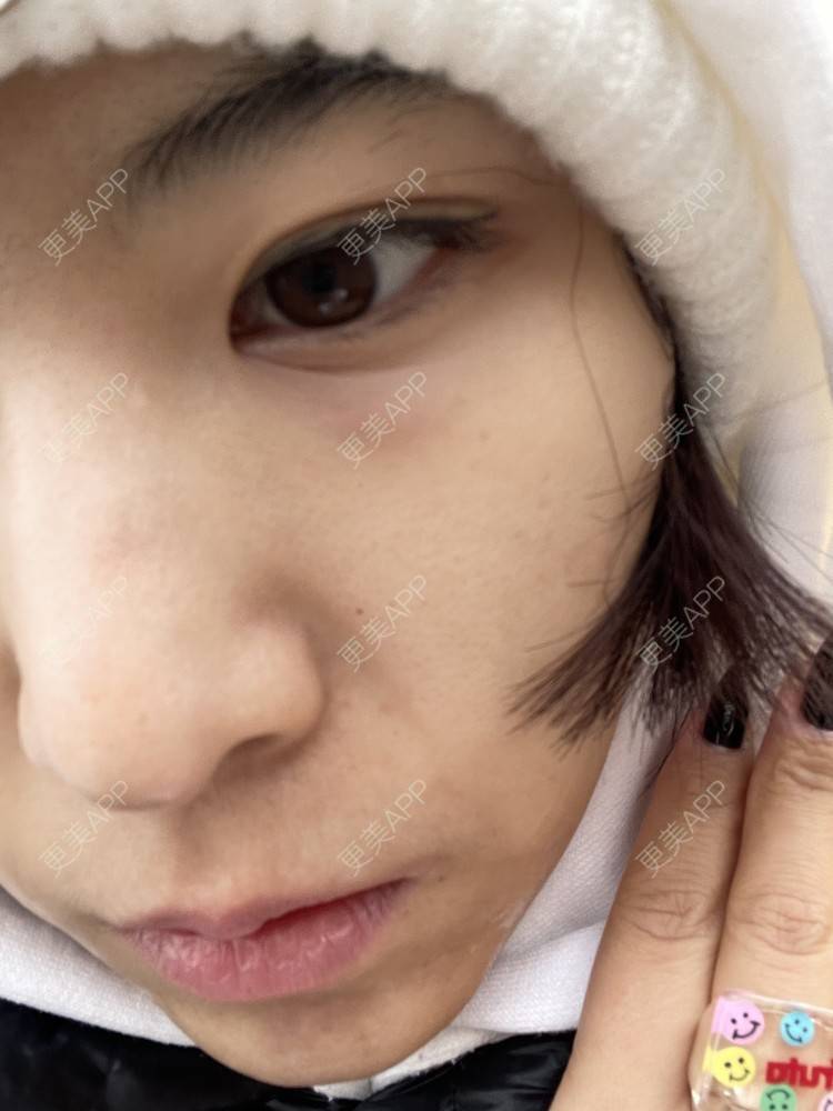 更美 - 麦可星-喵的水光项目经验 | 水光项目 | 大连