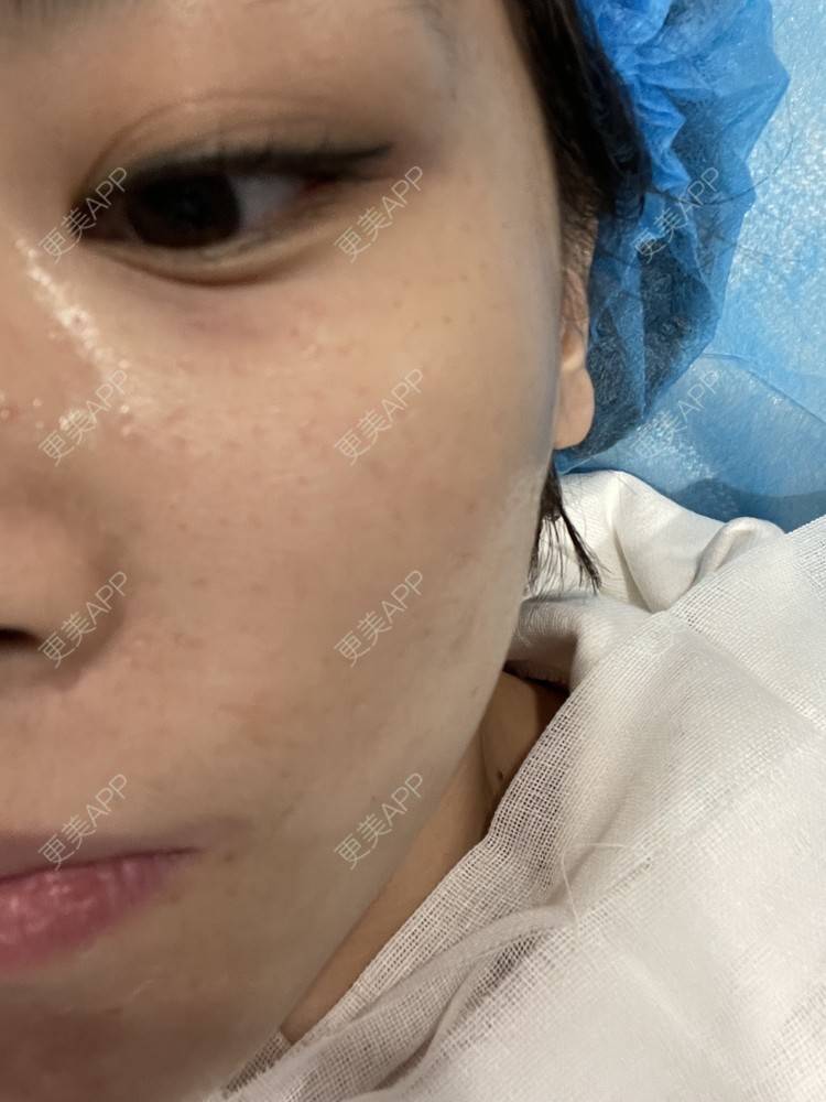 更美 - 麦可星-喵的水光项目经验 | 水光项目 | 大连