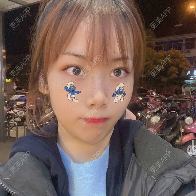 更美 - 悦悦悦耳的双眼皮经验 | 广州 | 双眼皮