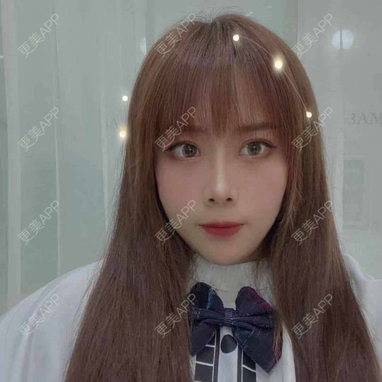 更美 - 悦悦悦耳的双眼皮经验 | 广州 | 双眼皮