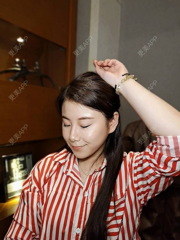 更美 - 更美用户YzIgvthL7D的耳软骨隆鼻经验 | 郑州 | 耳软骨隆鼻