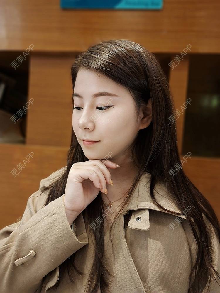 更美 - 更美用户YzIgvthL7D的耳软骨隆鼻经验 | 郑州 | 耳软骨隆鼻