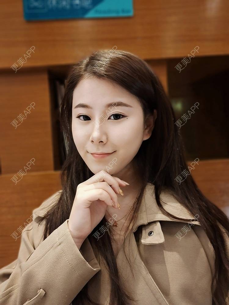 更美 - 更美用户YzIgvthL7D的耳软骨隆鼻经验 | 郑州 | 耳软骨隆鼻