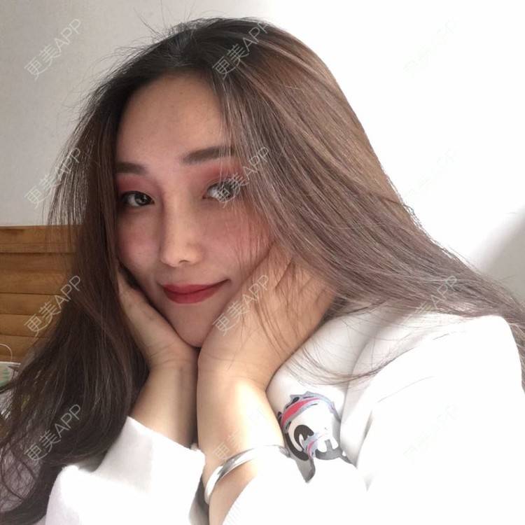 更美 - 小鱼儿yu的鼻部多项经验 | 鼻部多项 | 重庆