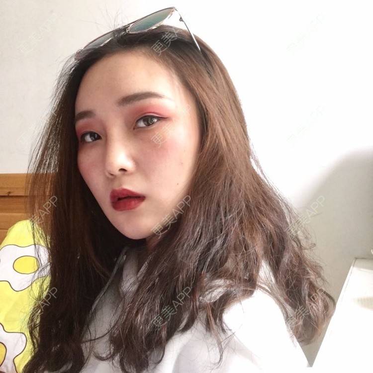 更美 - 小鱼儿yu的鼻部多项经验 | 鼻部多项 | 重庆