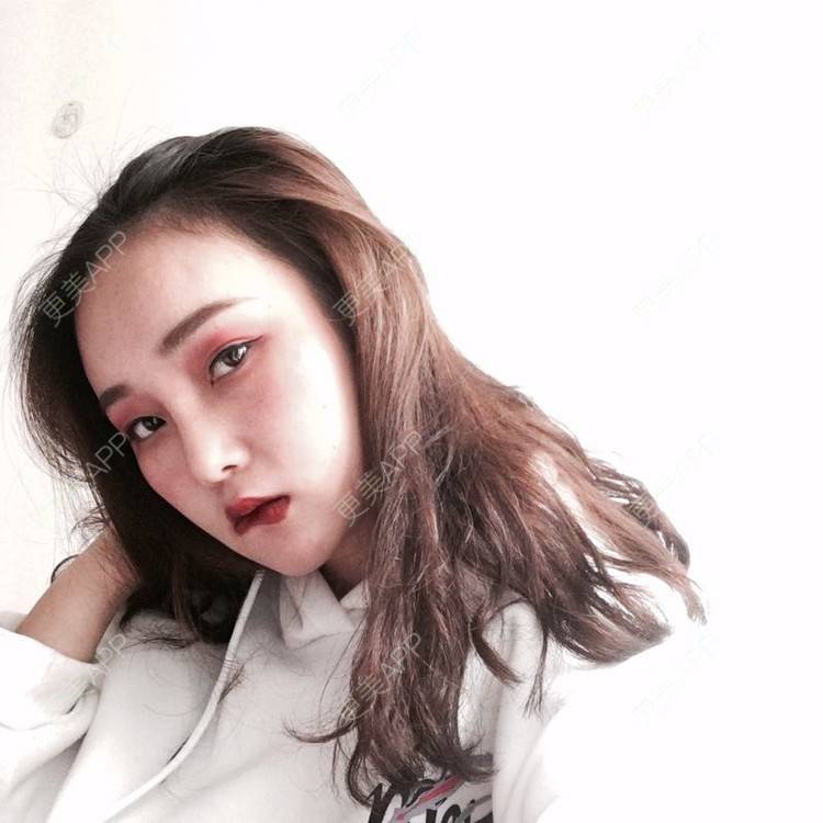 更美 - 小鱼儿yu的鼻部多项经验 | 鼻部多项 | 重庆