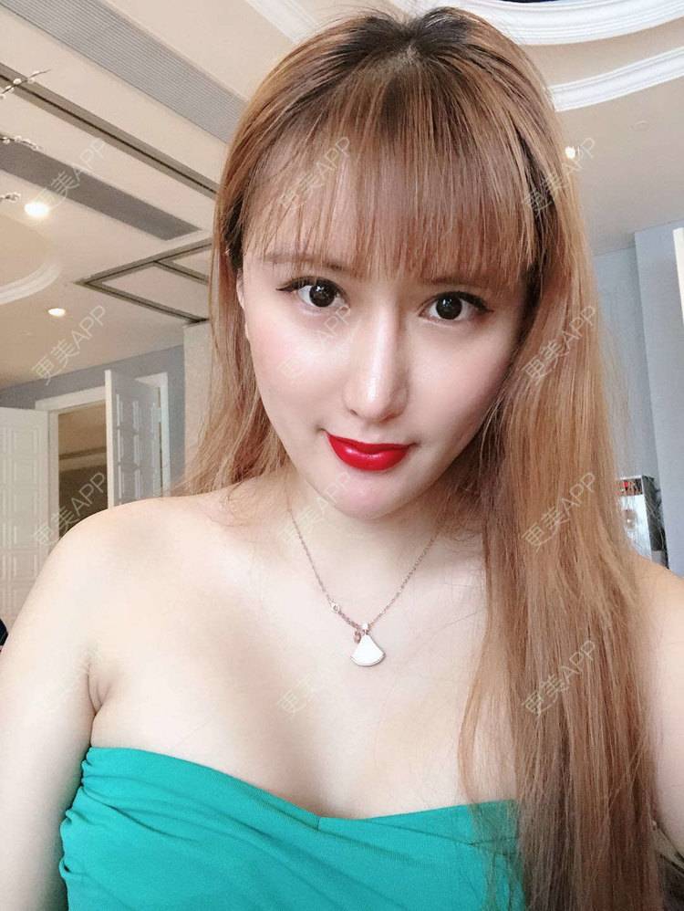 更美 - 再也不想吃泡面了的假体隆胸经验 | 广州 | 视频日记 | 假体隆胸