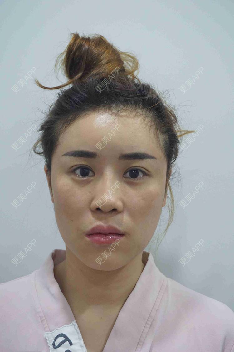 更美 - 穿花衣的燕子的鼻部多项经验 | 视频日记 | 鼻部多项 | 重庆