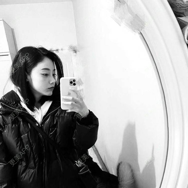 更美 - 烛雪的自体脂肪全面部填充经验 | 北京 | 自体脂肪全面部填充