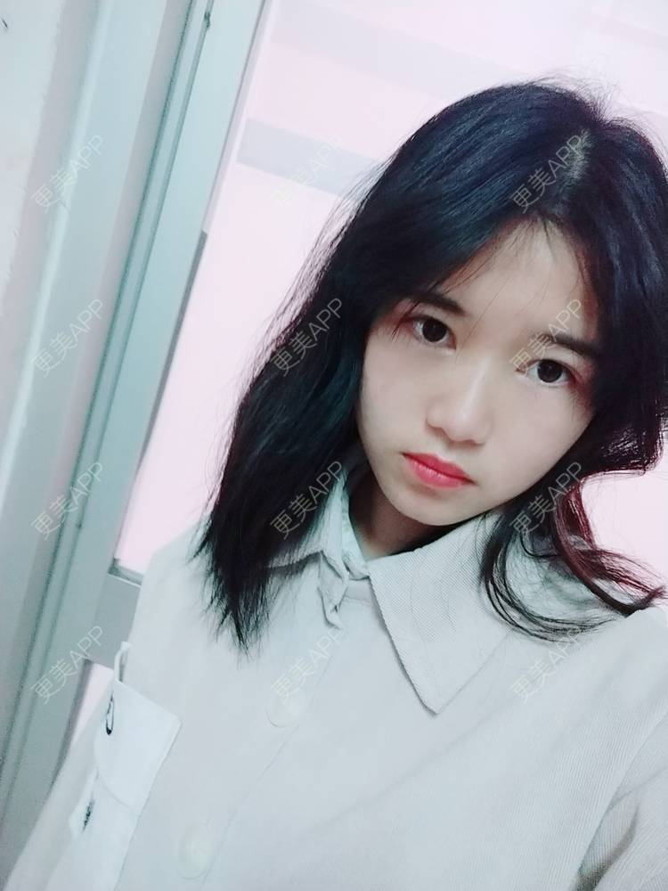 更美 - 更美用户lM8eMwz0OI的热玛吉经验 | 福州 | 热玛吉