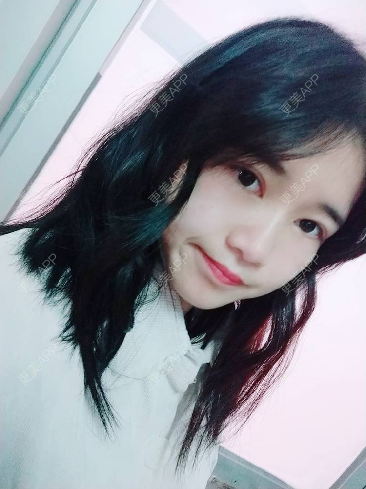 更美 - 更美用户lM8eMwz0OI的热玛吉经验 | 福州 | 热玛吉