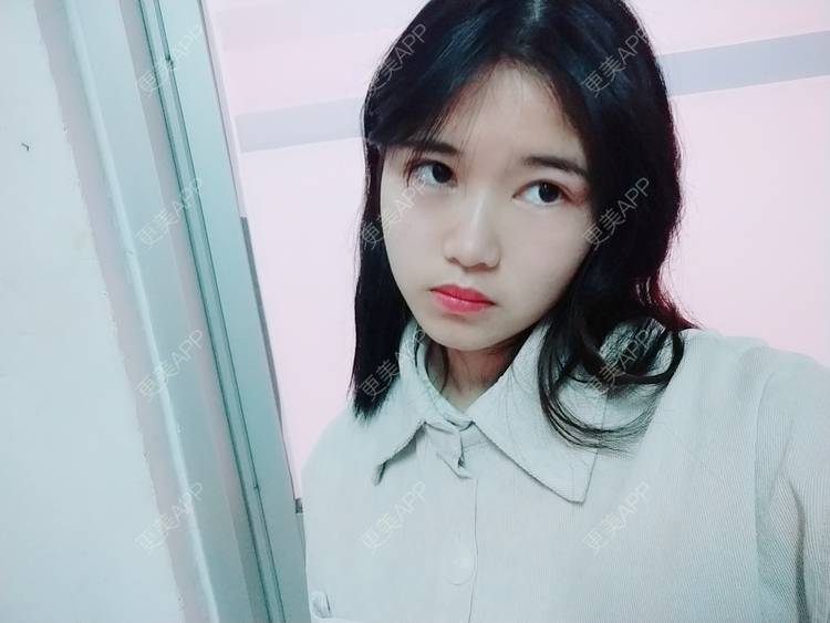 更美 - 更美用户lM8eMwz0OI的热玛吉经验 | 福州 | 热玛吉