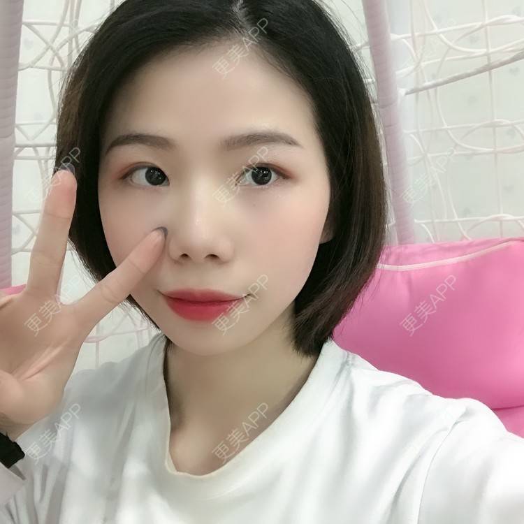 更美 - 更美用户XALPc5RVJ3的热玛吉经验 | 广州 | 热玛吉