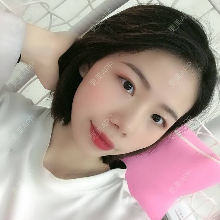 更美 - 更美用户XALPc5RVJ3的热玛吉经验 | 广州 | 热玛吉