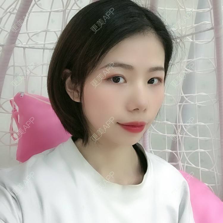 更美 - 更美用户XALPc5RVJ3的热玛吉经验 | 广州 | 热玛吉