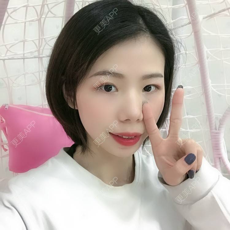 更美 - 更美用户XALPc5RVJ3的热玛吉经验 | 广州 | 热玛吉