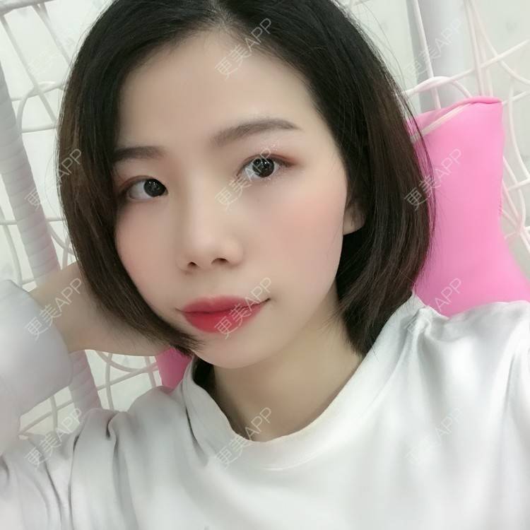 更美 - 更美用户XALPc5RVJ3的热玛吉经验 | 广州 | 热玛吉