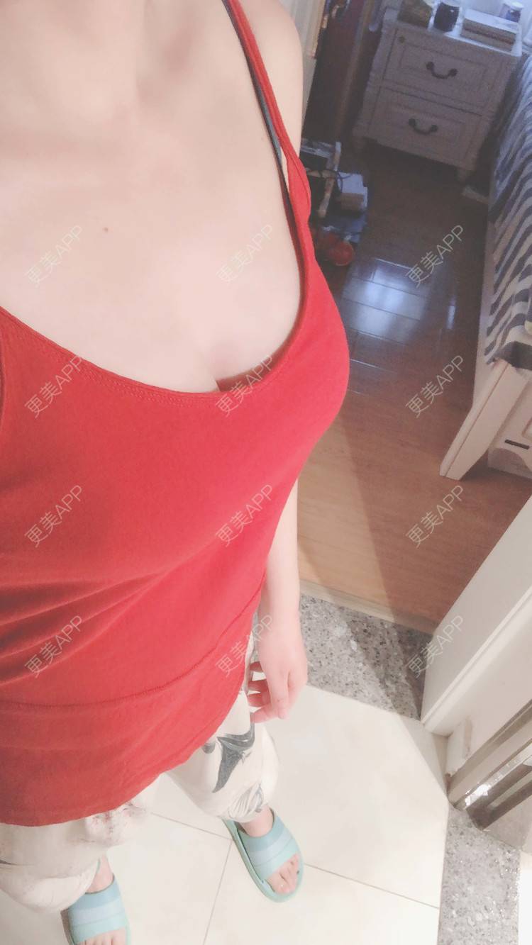更美 - 述禾狈的自体脂肪隆胸经验 | 北京 | 自体脂肪隆胸 | 视频日记