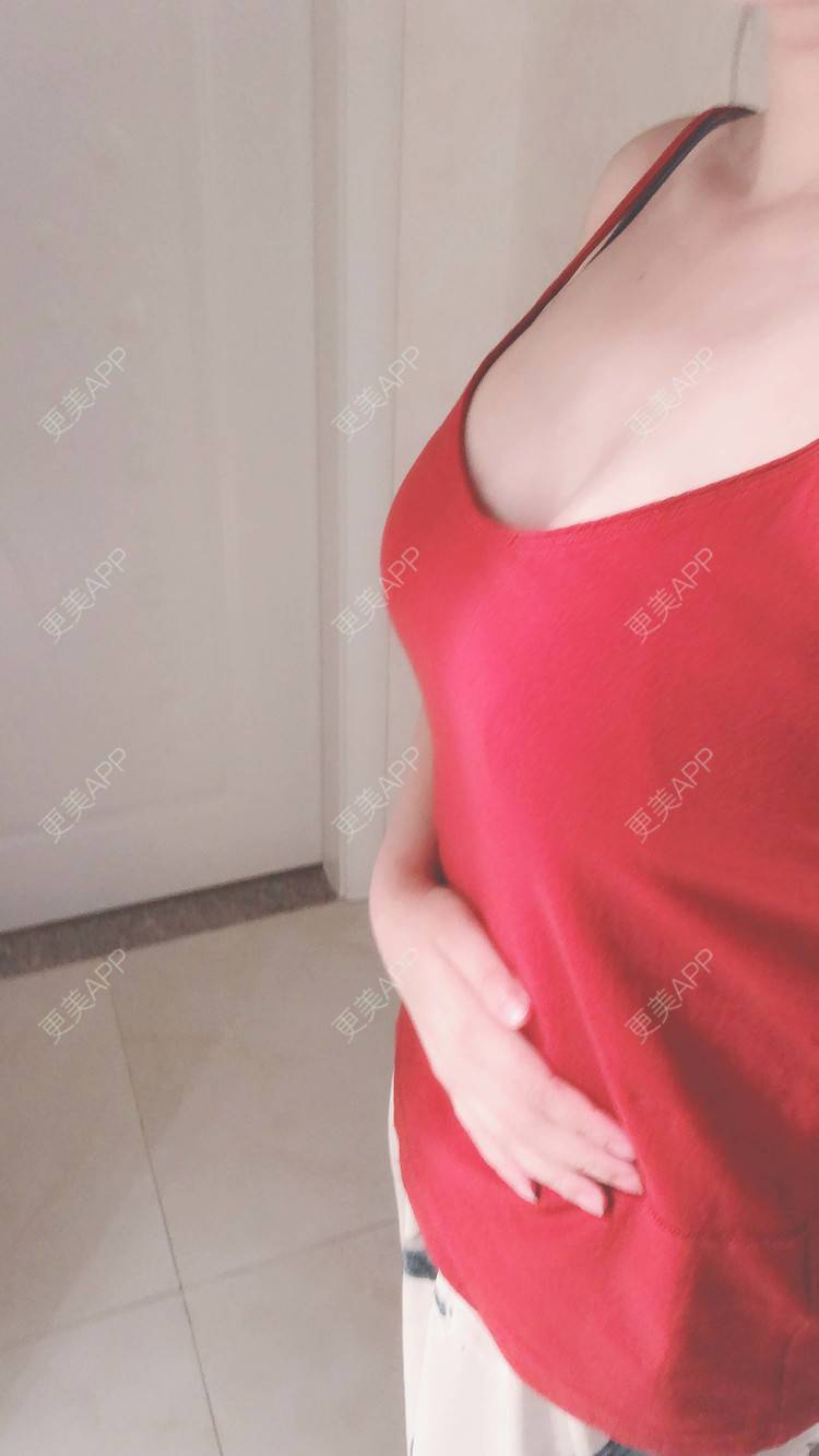 更美 - 述禾狈的自体脂肪隆胸经验 | 北京 | 自体脂肪隆胸 | 视频日记