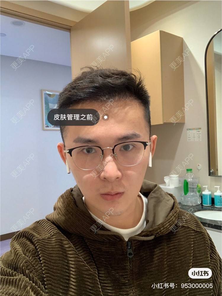 更美 - 更美用户WwwH8E0LBK的水光项目经验 | 广州 | 水光项目