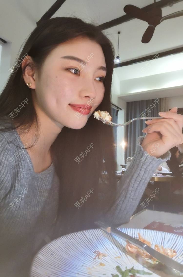 更美 - 更美用户82701801的树脂补牙经验 | 杭州 | 树脂补牙