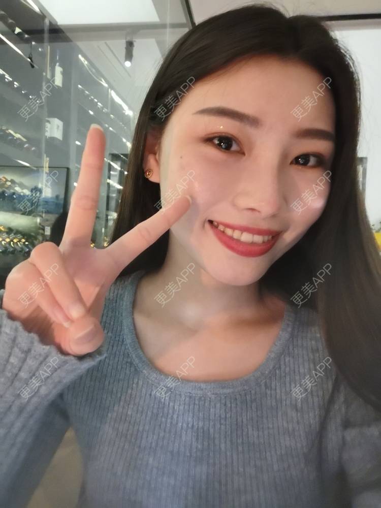 更美 - 更美用户82701801的树脂补牙经验 | 杭州 | 树脂补牙