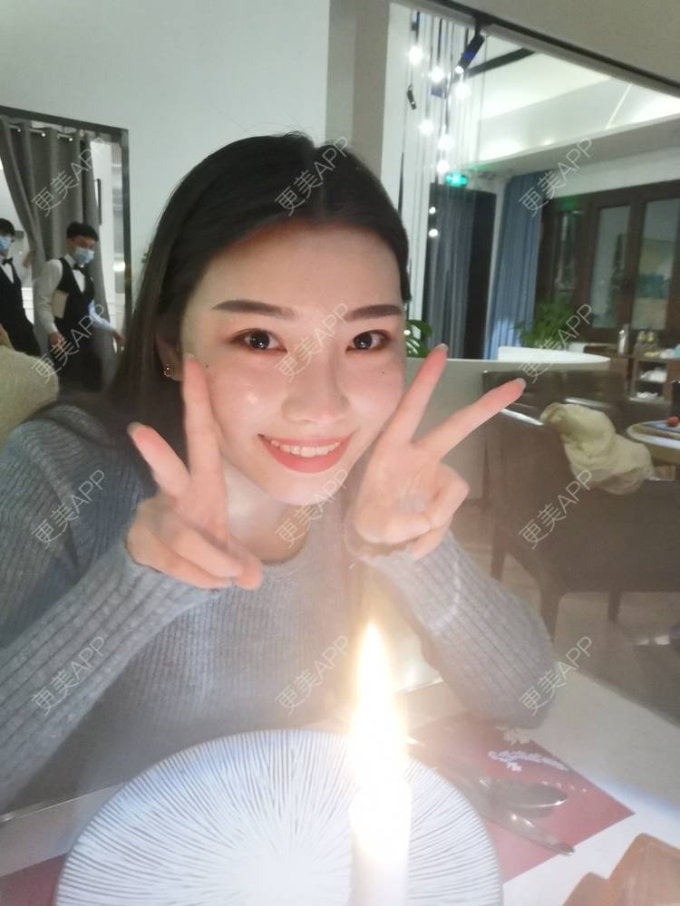更美 - 更美用户82701801的树脂补牙经验 | 杭州 | 树脂补牙