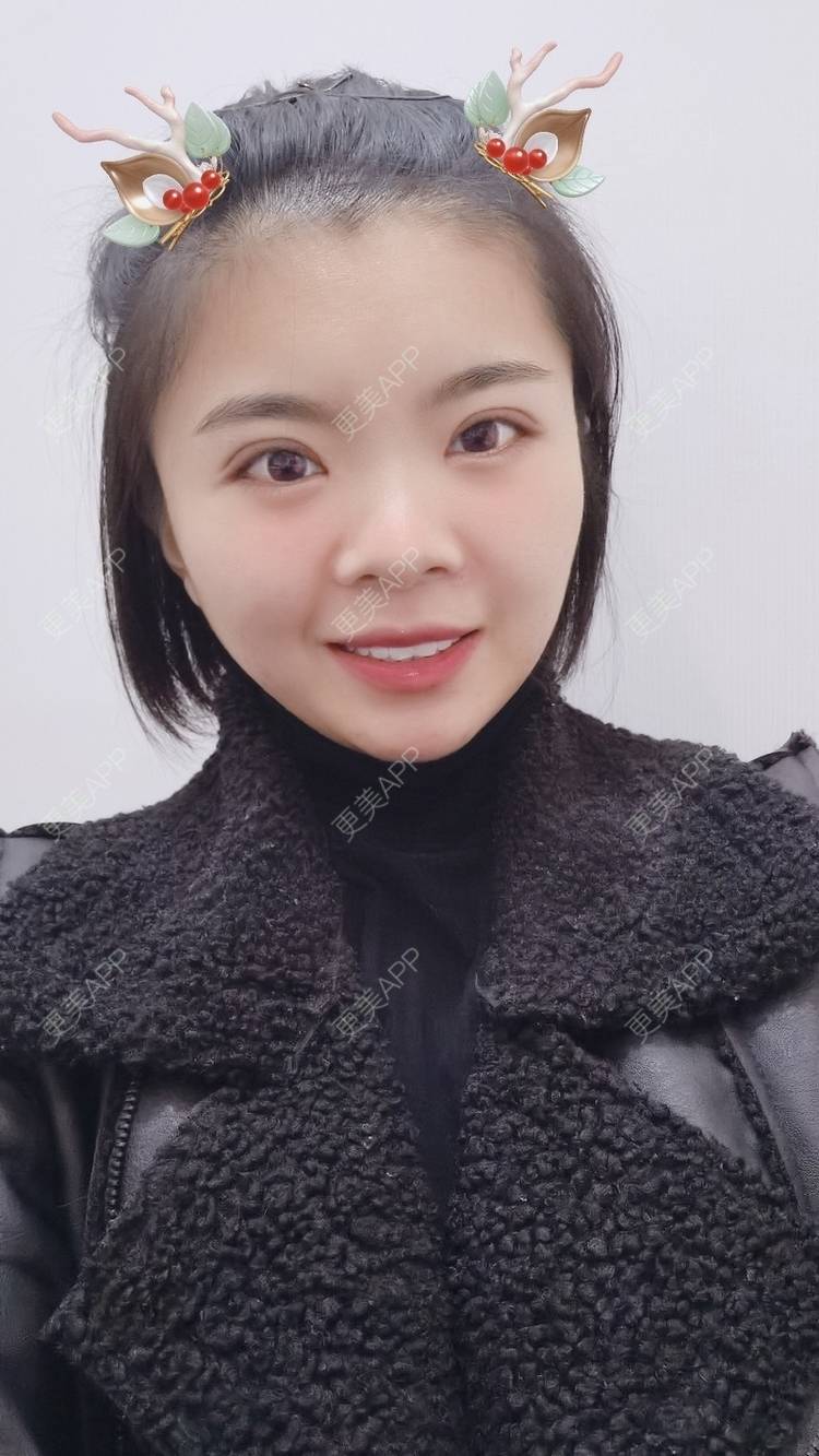 更美 - 小太阳77的手术淡疤经验 | 激光点痣 | 手术淡疤