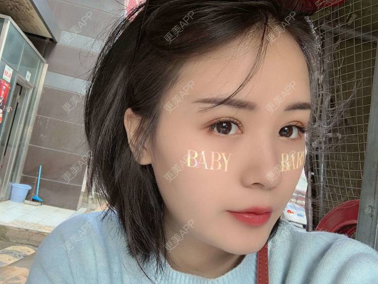 更美 - 草莓味之夏的双眼皮经验 | 眼部多项 | 广州 | 视频日记 | 双眼皮