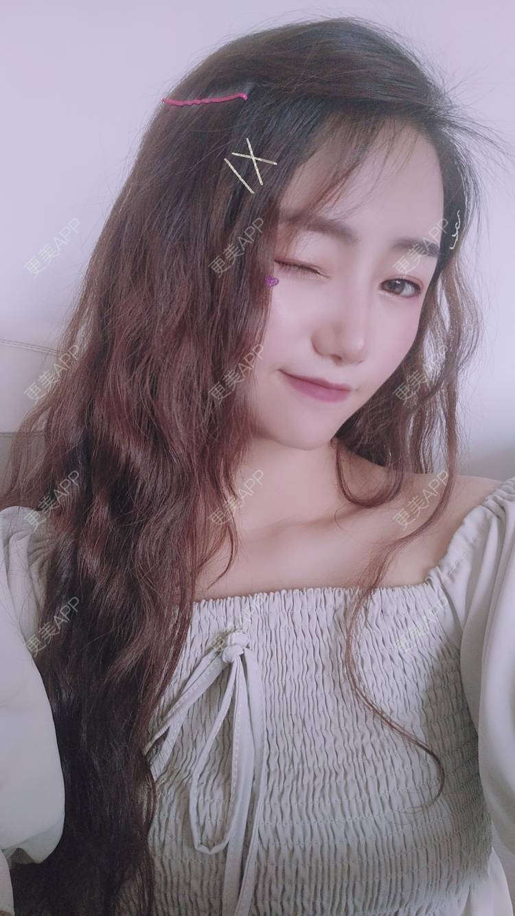 更美 - 眷恋着你的温柔傥的自体脂肪全面部填充经验 | 自体脂肪全面部填充 | 南京