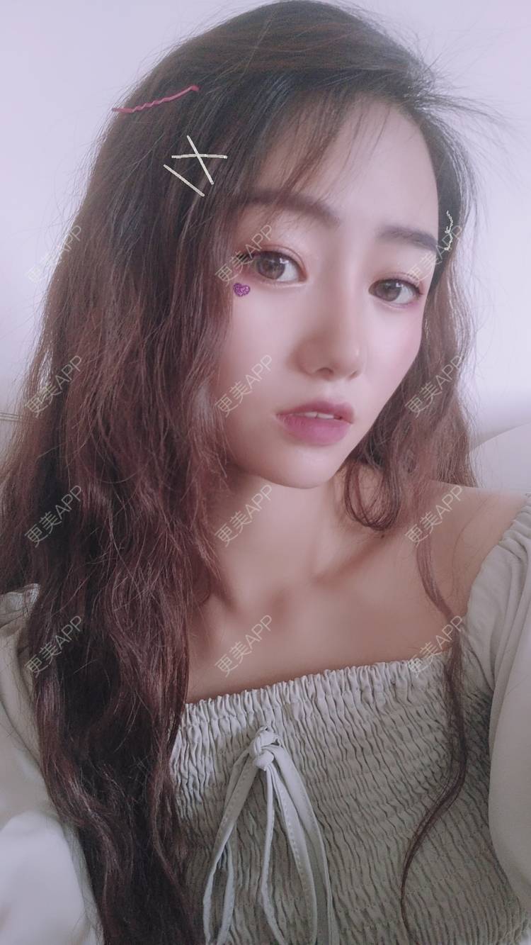 更美 - 眷恋着你的温柔傥的自体脂肪全面部填充经验 | 自体脂肪全面部填充 | 南京