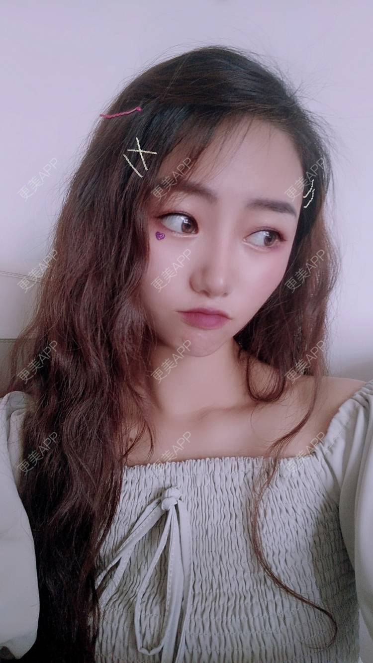 更美 - 眷恋着你的温柔傥的自体脂肪全面部填充经验 | 自体脂肪全面部填充 | 南京