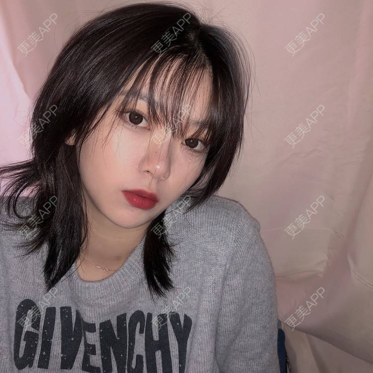 更美 - 星语星愿1的下颌角切除经验 | 广州 | 下颌角切除