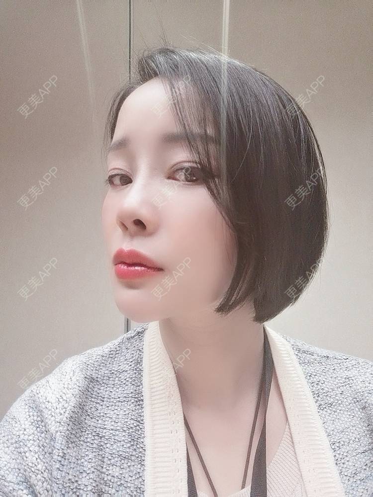 更美 - 🐷🐮仔仔仔的热玛吉经验 | 上海 | 热玛吉