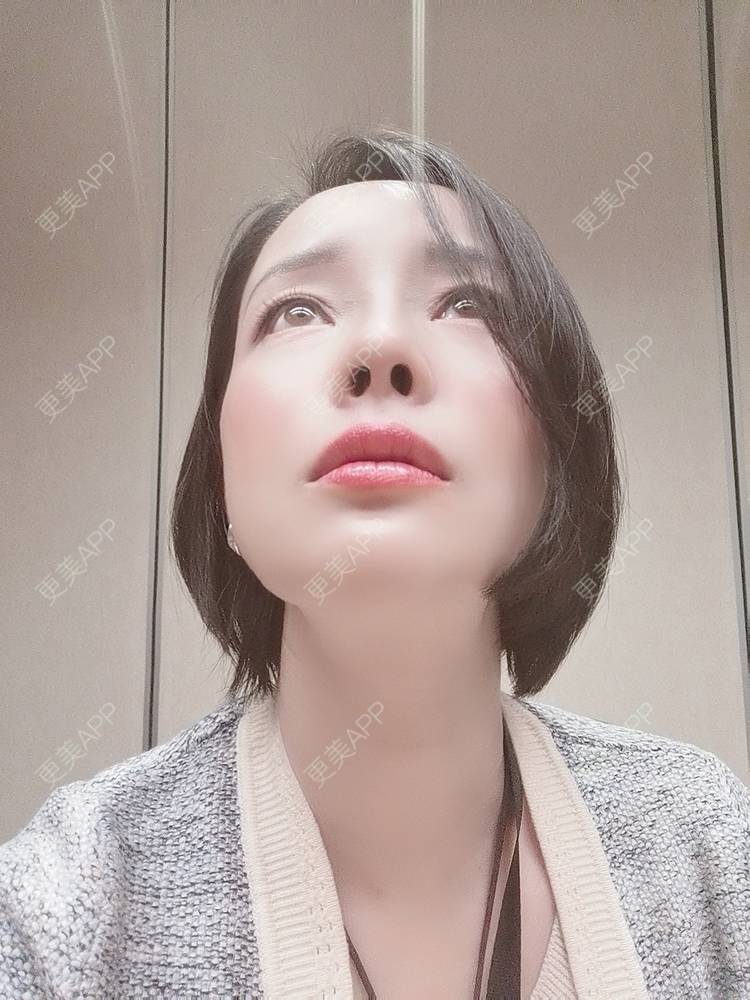 更美 - 🐷🐮仔仔仔的热玛吉经验 | 上海 | 热玛吉