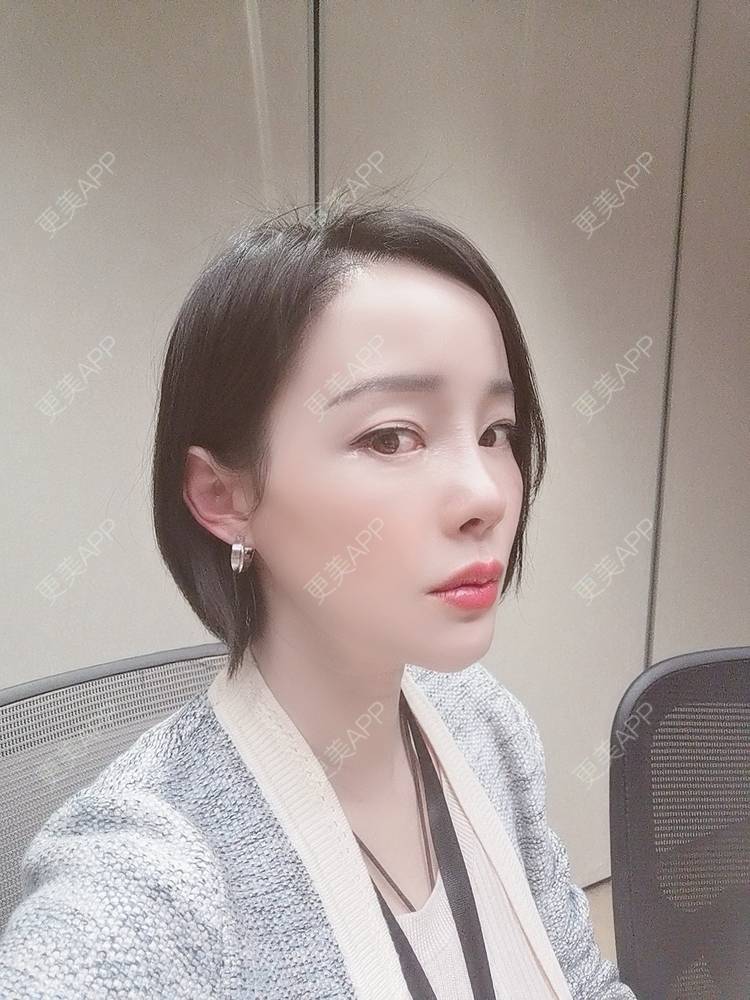 更美 - 🐷🐮仔仔仔的热玛吉经验 | 上海 | 热玛吉