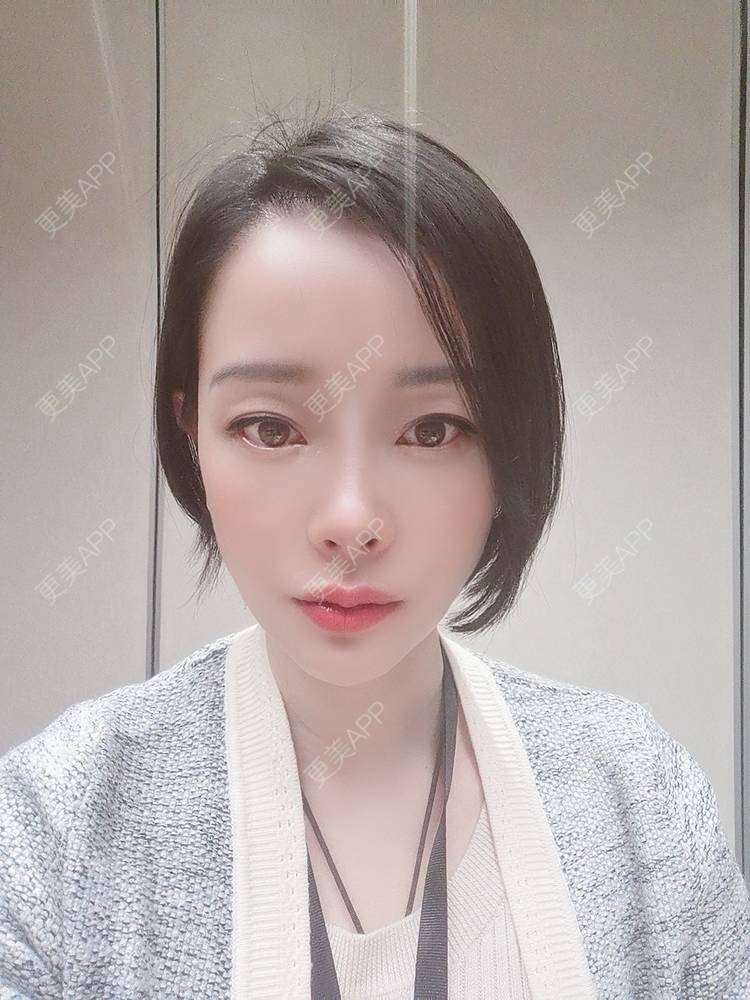 更美 - 🐷🐮仔仔仔的热玛吉经验 | 上海 | 热玛吉