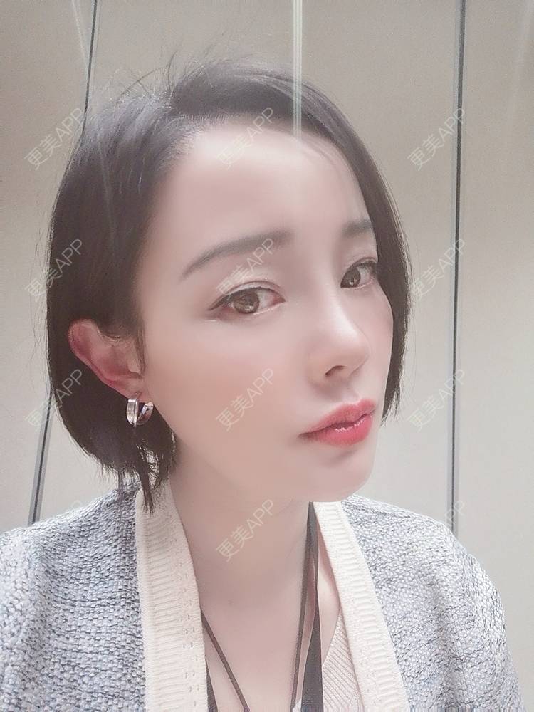 更美 - 🐷🐮仔仔仔的热玛吉经验 | 上海 | 热玛吉