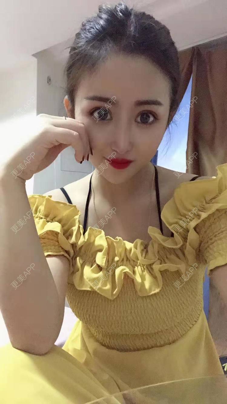 更美 - 习惯在背后吻她的丰胸（隆胸）经验 | 成都 | 丰胸（隆胸） | 视频日记 | 假体隆胸 | 胸部下垂矫正