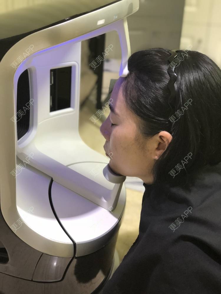 更美 - 更美用户SlOdw7zLNS的淡斑套餐经验 | 淡斑套餐 | 重庆