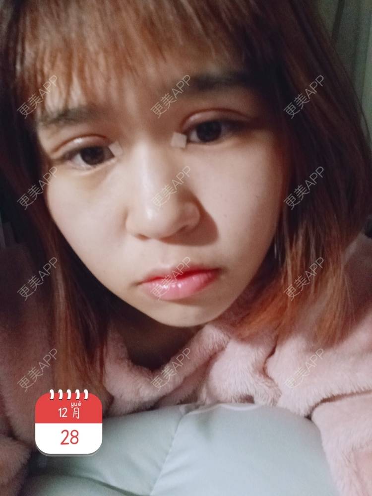更美 - auci的眼部多项经验 | 昆明 | 眼部多项
