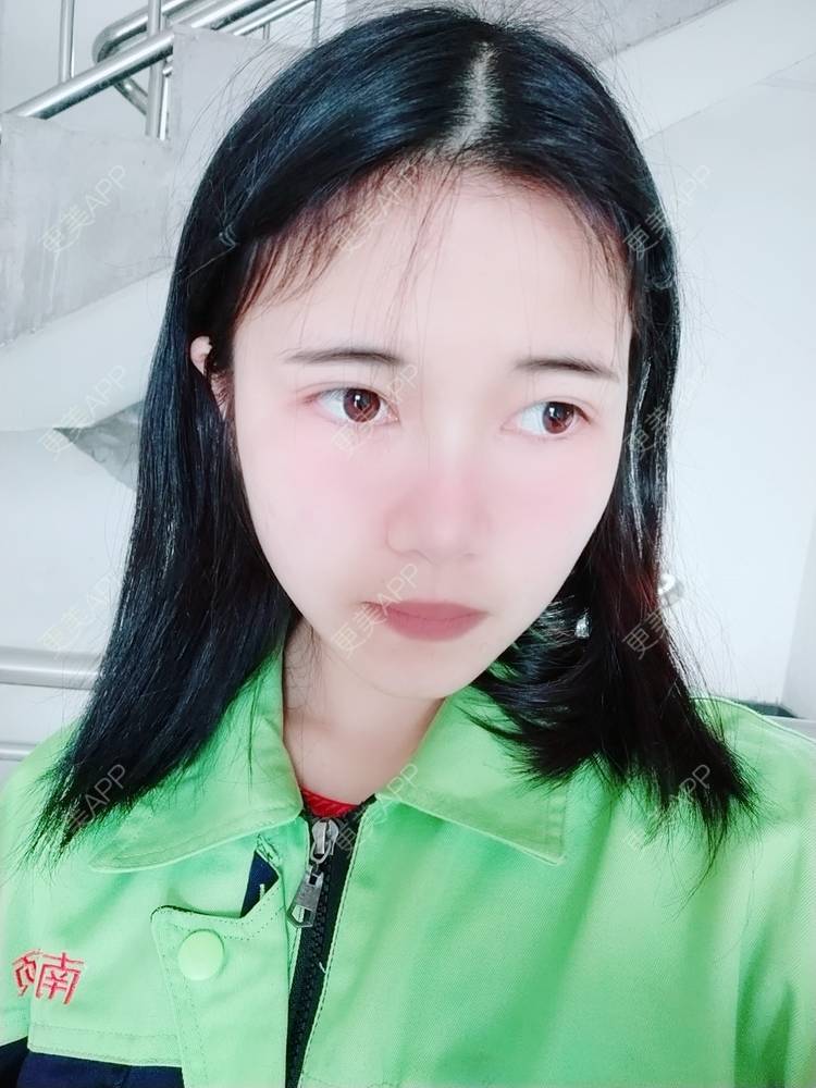 更美 - 更美用户lM8eMwz0OI的热玛吉经验 | 福州 | 热玛吉